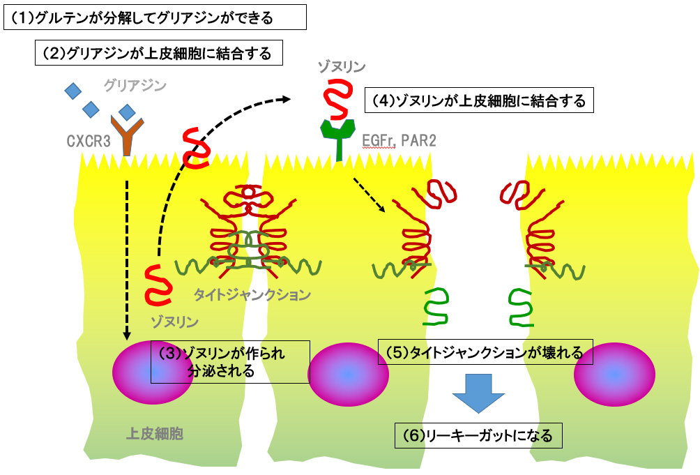 グルテンによるリーキーガット誘発のメカニズム