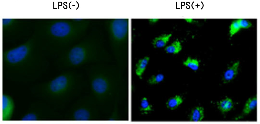 LPSによるオートファジーの促進