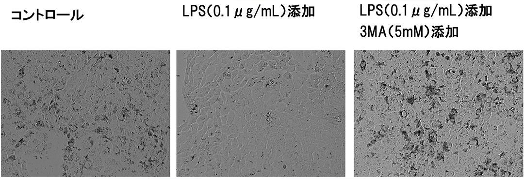LPSは、ケラチノサイトのオートファジーによるメラノソーム分解を促進する