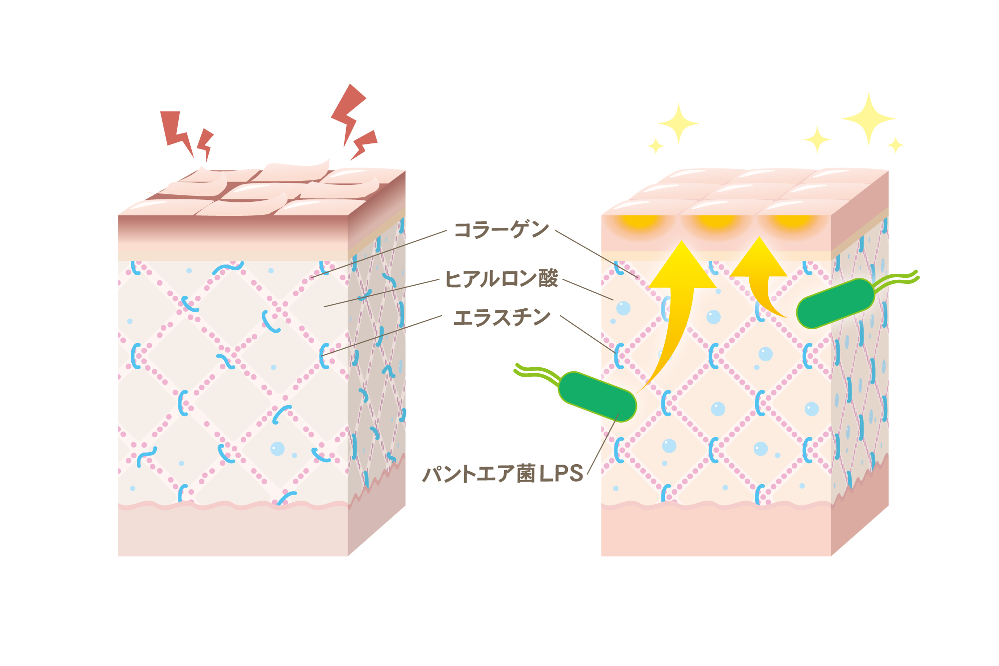 肌のハリと弾力を高める、コラーゲン、ヒアルロン酸、エラスチン、LPS