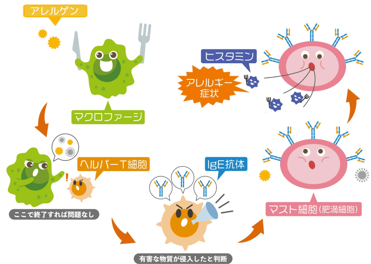 湿疹ができるメカニズム