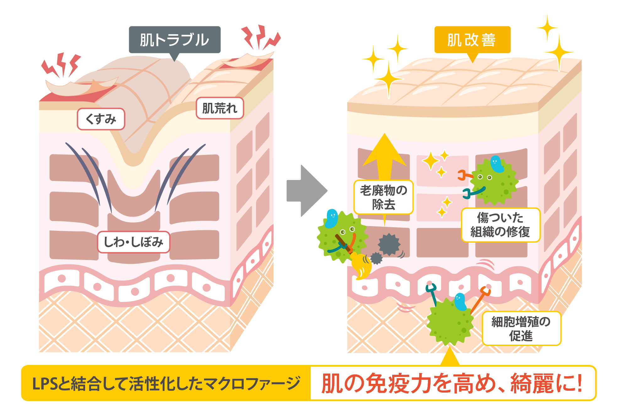 肌トラブルを改善するLPSの働き