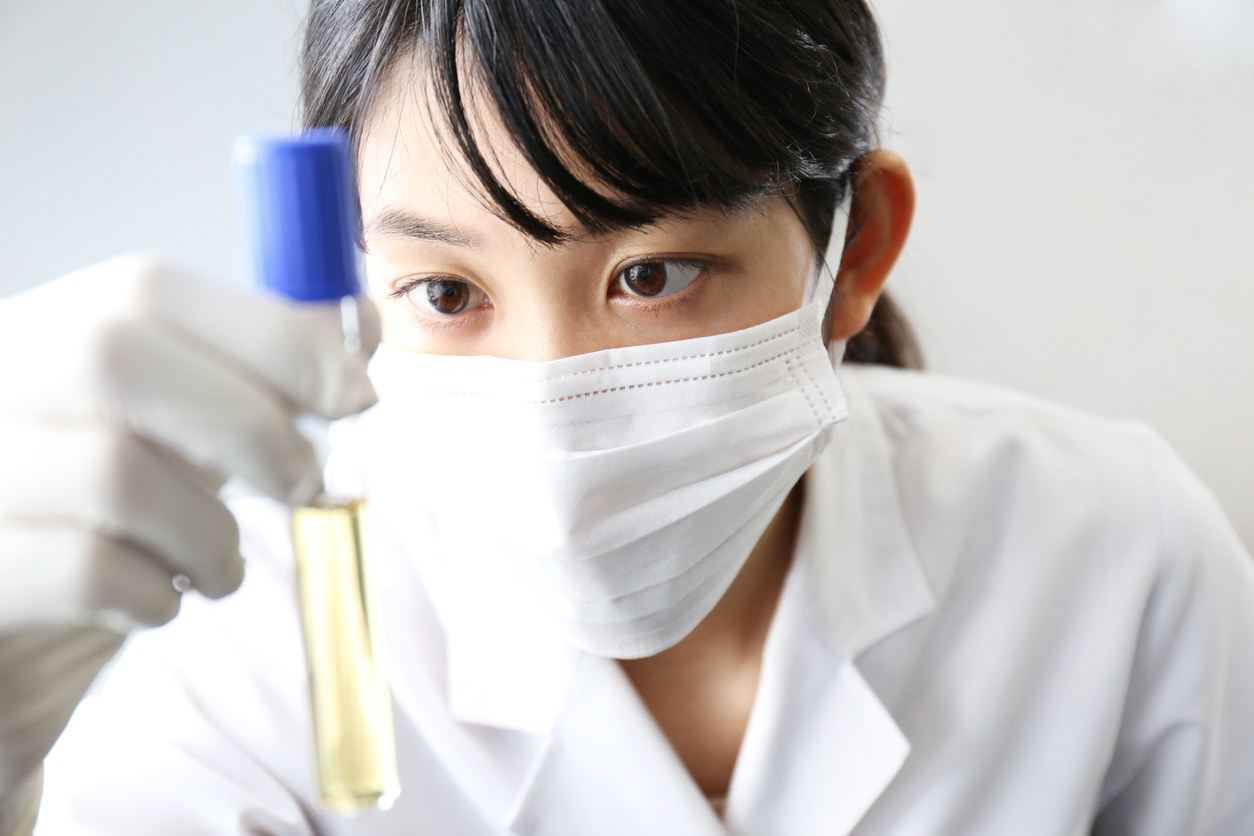 LPSとはどんなもの？構造や働きについてわかりやすく解説