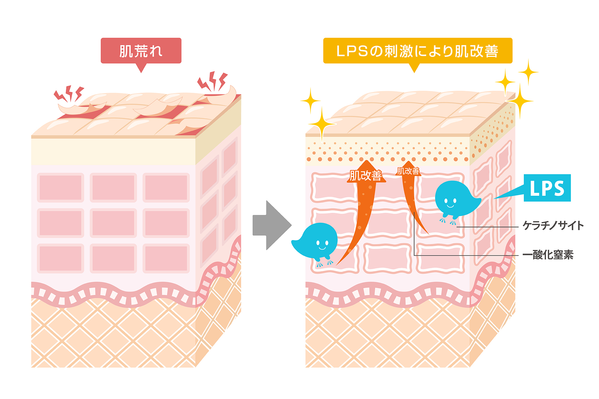 傷の治りを早める、ランゲルハンス細胞の活性化、一酸化窒素を放出、LPSの作用